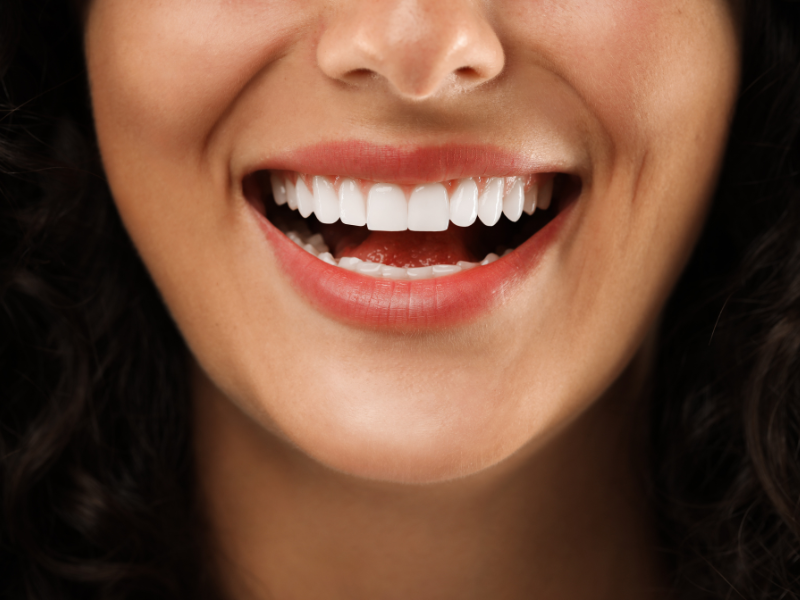 Estética dental
